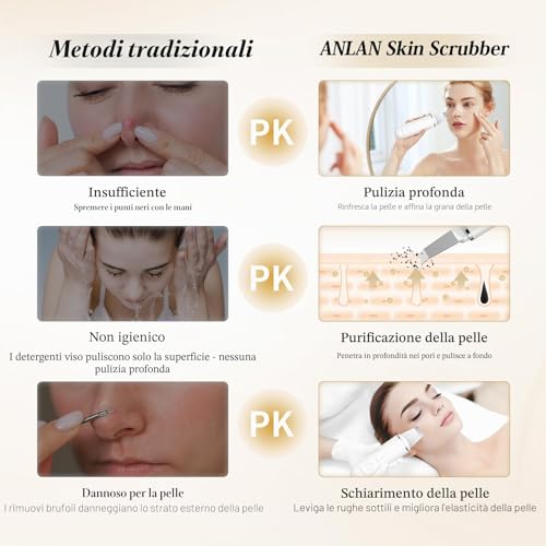 ANLAN Professional Ultrasonic Facial Cleansing Skin Scrubber for Deep Cleansing the Face Peeling and Care, 4 Modes Blackhead Removal, USB Rechargeable