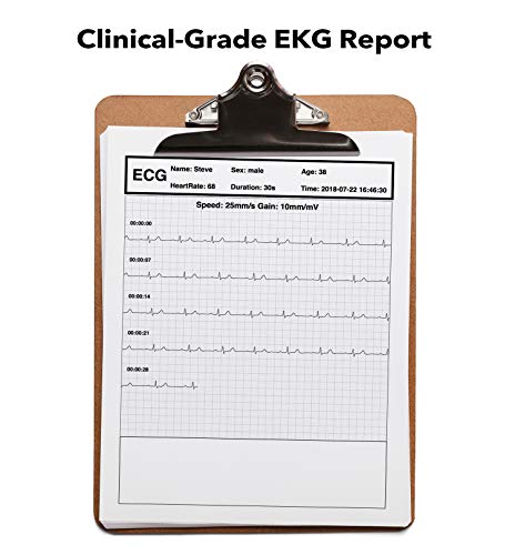 EMAY Heart Health Tracker (PC Software for Windows & Mac) | Heart Rate & Rhythm Recording