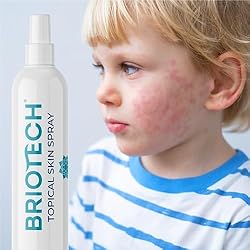 BRIOTECH Topical Skin Spray, Pure Hypochlorous Acid