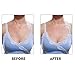 Silicone Care Neck Pad & Pad For Chest Wrinkles -100% Medical Grade Silicone Anti Wrinkle Chest Pads&Neck Pad to Prevent and Diminish Wrinkles - Reusable Overnight Anti Wrinkle Remover