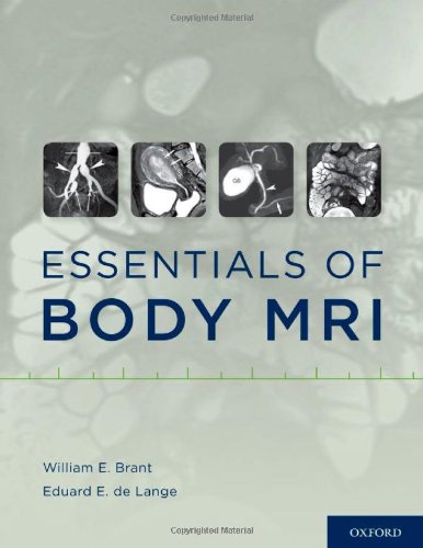 Essentials of Body MRI (Hardcover)