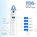 Blackhead Remover Vacuum, Facial Pore Cleanser for Stubborn Blackheads USB Rechargeable Blackhead Sucker Electric Skin Cleanser Blackhead Extractor Tool Skin Pore (Blue)