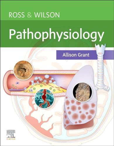 MacSween's Pathology of the Liver: 9780702082283: Medicine