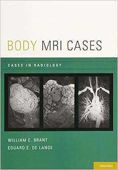 Body MRI Cases (Cases in Radiology) Body MRI Cases (Cases in Radiology)