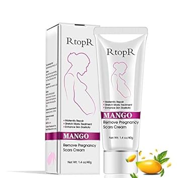 rtopr mango stretch mark cream
