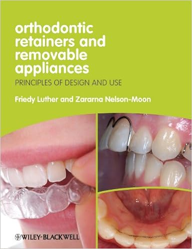 Buy Orthodontic Retainers And Removable Appliances Principles Of Design And Use Book Online At Low Prices In India Orthodontic Retainers And Removable Appliances Principles Of Design And Use Reviews Ratings