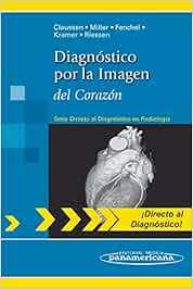 Diagnostico por la imagen del corazon: del corazón (Directo Al Diagnostico En Radiologia / Direct Diagnosis in Radiology)