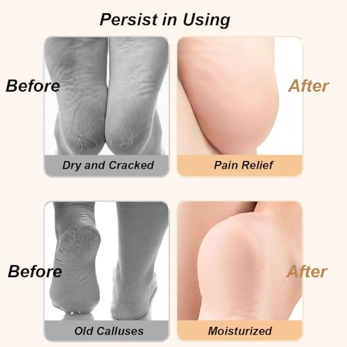 Paratoland 2 Pairs Reusable Silicone Socks for Dry Cracked Feet - Spa Moisturizing Socks for Men and Women - Foot Care After Pedicure