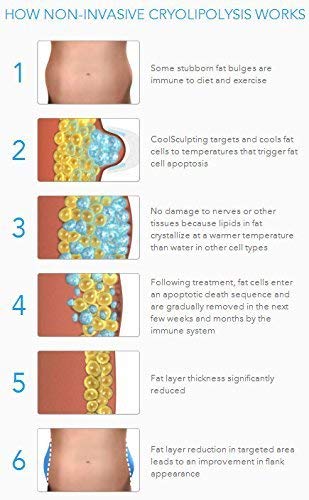 Fat Freezer Original Spa Fat Freezing System - Fat Slimming Procedure Alternative at Home Slimming Kit