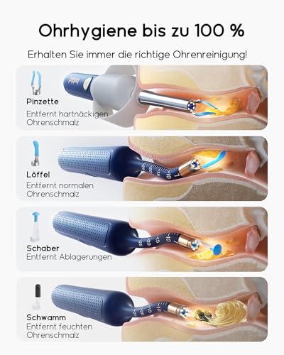 BEBIRD Earsight Plus R37R Kit De Ferramentas Para Limpeza e Remoção De Cera Do Ouvido, Câmera Otoscópica Flexível Com Luz, Pinça Sem Fio Para Remoção De Cera Do Ouvido (Azul)