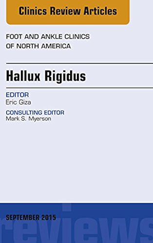 Download Hallux Rigidus, An Issue of Foot and Ankle Clinics of North America, E-Book (The Clinics: Orthopedics) (English Edition) PDF