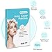 Acne Patch(108 Count), Poppyo Acne Care Pimple Patch Absorbing Round Pads, Blemish Covers - Hydrocolloid Bandages(2 sizes), Acne Spot Treatment for Face & Skin Spot Patch That Conceals Acne