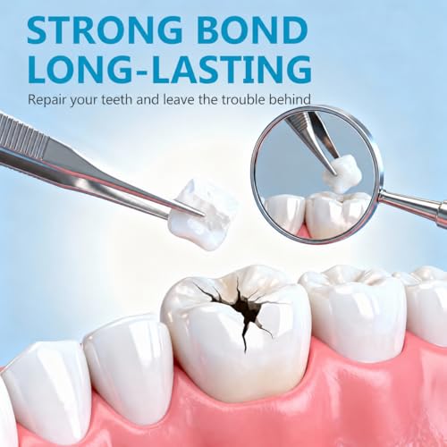 Tooth Filling Repair Kit, Temporary Tooth Filling, Home Use Tooth Repair Kit for Restoring Missing Dentures and Fractured Teeth, Regain Confidence Smile, 1 Count (Pack of 1)