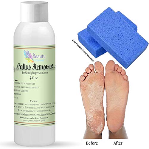 4 oz Callus Remover, with pumice stone. Callus Eliminator,Liquid & Gel