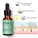 Hair Growth Serum, Y.F.M Herbal Hair Growth Essence - Hair Loss Prevention Treatment For Men & Women With Thinning Hair - Stimulate Hair Follicles, Strengthens Hair Roots and Help Regrow Hair - 20ml