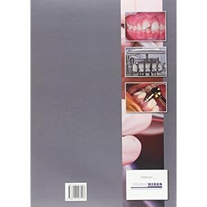 EXPLORACION DE LA CAVIDAD ORAL (TEC.SUP.HIGIENE BUCODENTAL)