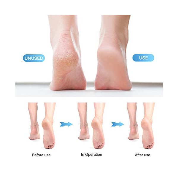 16-in-1-Professional-Foot-File-Pedicure-Kit-hicoosee-Nail-Toenail-Clipper-Dead-Foot-Skin-Remover-for-Foot-and-Hand 16 in 1 Professional Foot File Pedicure Kit, hicoosee Nail Toenail Clipper Dead Foot Skin Remover for Foot and Hand