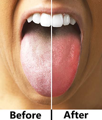 1 Tongue+Scraper+Ayurvedic+Cleaner+Hygiene