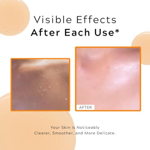 LBOYLOVE® 2 PCS Body Keratin Care Turmeric Spray & Exfoliating Serum for Face, Gently Exfoliating Peeling & Refines Skin, Turmeric Serum Hydration and Supports Smoother - for All Skin Types
