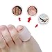 Sumifun Gel Pinky Toe Sleeves, Transparent Toe Cushion for Relief Little Toe, (6PCS Thin+6PCS Thick) Silicone Toe Protectors Blisters, Calluses Toenails Loss, Friction Pain Relief