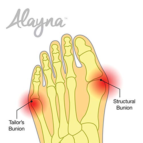 Bunion Corrector and Bunion Relief Sleeve with Gel Pad Cushion Bunion Protector - Protection and Treatment for Hallux Valgus Bunion Pain (1 Pair) Medium - Thumbnail 4