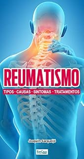 Livro Minibook Reumatismo; Tipos, causas, sintomas e tratamentos