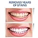 Teeth Whitening Kit Dental Teeth Whitener Removes Stains Effectively, Non Sensitive Safe for Enamel, Led Light with 5 Bulbs, 3×3ml Gel Syringes