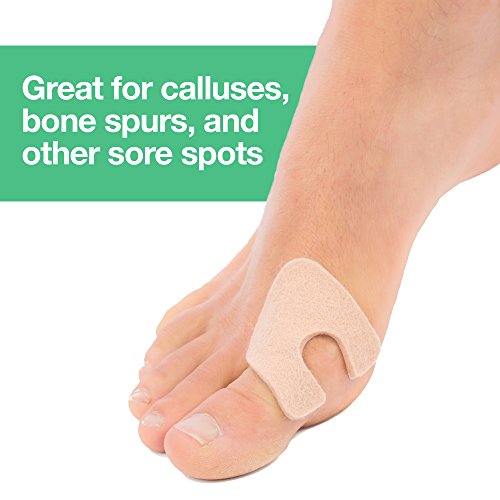 ZenToes UShaped Felt Callus Pads Protect Calluses from Rubbing on