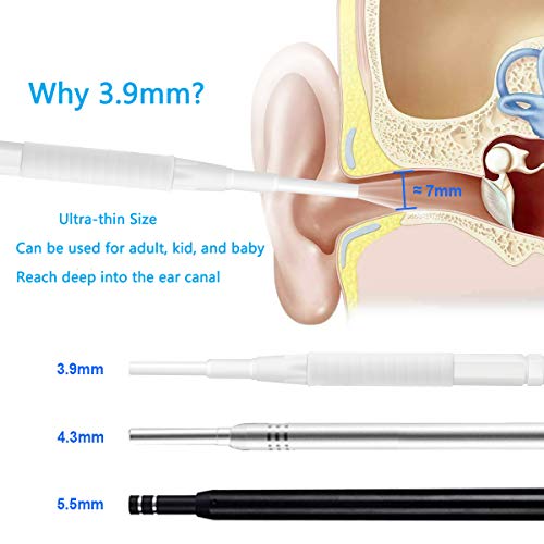 USB Otoscope, 3.9mm Ultra-Thin Digital Otoscope Camera, 720P Ear Inspection Endoscope Visual Ear Scope Cleaner with Ear Wax Remover Cleaning Tool and 6 Adjustable LED Light for Android, Windows, Mac