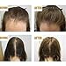 SHL ReGrowth Serum,Hair Care Essential Oil - Treatment for Soft Hair Pure 30ML Nourish Scalp Repair Dry Damage Hair Salon, Nourish Hair Growth,Strengthen Hair Roots Thickening (30ML1PC)