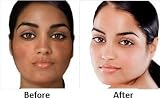 First Lady Skin Brightening Glycerin AHA Fruit Acids 400ml Dry Skin view 4
