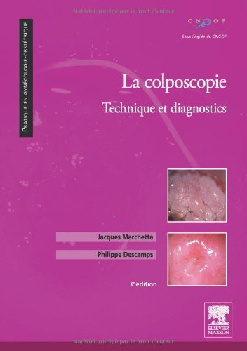 La  colposcopie