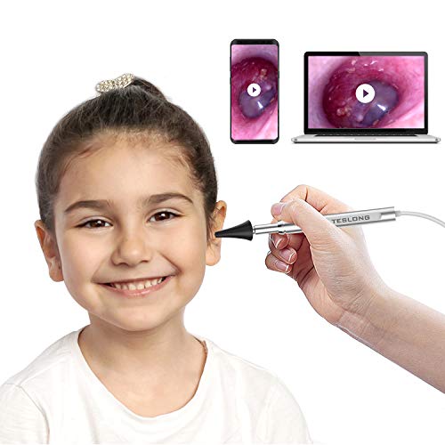 Teslong Digital Otoscope, Visual Ear Wax Removal Tool with HD Ear