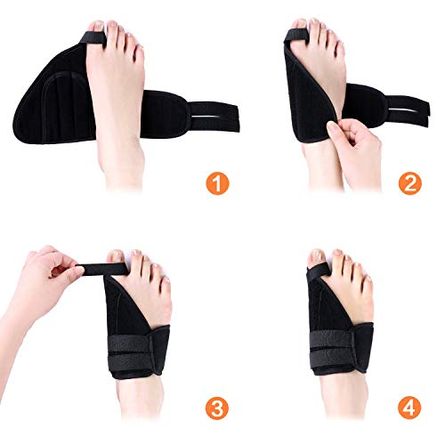 FanProd Bunion Corrector, Bunion Splint, Bunion Relief, Orthopedic Bunion Corrector, Bunion Brace for Women, Toe Brace,Straightener, Toe Corrector, Toe Splint, Unisex.