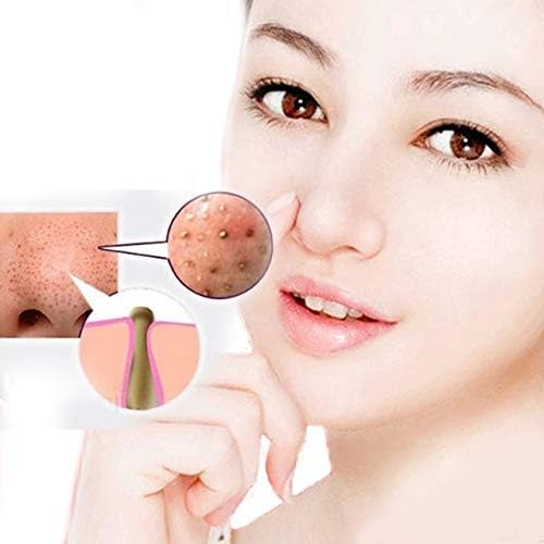 Acne Patch Face Pore Deep Cleansing Purifying Peel Off Acne Black Mud Remover Pore Cleanser For Nose Facial Acne Scar Treatment