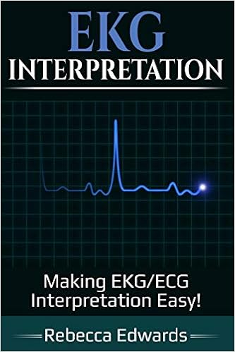 Ekg Interpretation Making Ekg Ecg Interpretation Easy Edwards Rebecca 9781729386507 Amazon Com Books