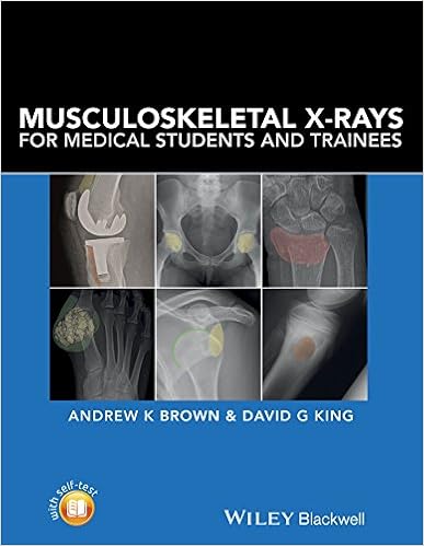 Musculoskeletal X Rays For Medical Students And Trainees 9781118458730 Medicine Health Science Books Amazon Com