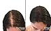Masquerade Medium Blonde Hair Building Fiber Hair Powder to give Men and Women a Full Thicker Looking Head of Hair .25g/.88oz bottle for Thinning hair. Natural Hair Loss Concealer in 9 Colors