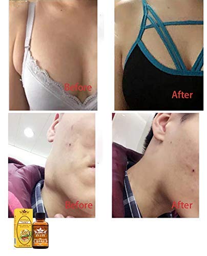 Natures Ginger Oil Essential Massage Scrubbing Oil 100% For Men & Women Promote Blood Circulation Relieve Muscle Soreness Pure Natural