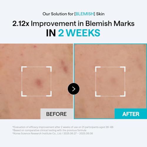 MEDIHEAL Madecassoside Blemish Toner Pads for Face – Korean Skin Care, 98% Pure Madecassoside with Centella Asiatica Complex, Blemish Marks, Redness & Dark Spot Care, Gauze Fabric, 100 Pads