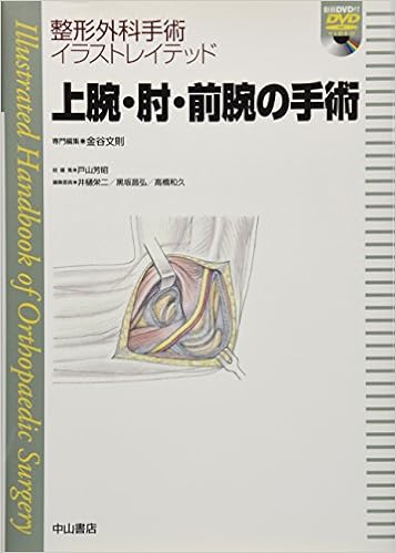 上腕 肘 前腕の手術 Dvd付き 整形外科手術イラストレイテッド 金谷文則 戸山芳昭 本 通販 Amazon 上腕 肘 前腕の手術 Dvd付き 整形外科手術イラストレイテッド 金谷文則 戸山芳昭 本 通販 Amazon