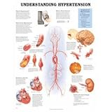Understanding Hypertension Anatomical Chart, Anatomical Chart Company Staff, 1587794225