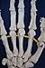 Wellden Cranstein A-324 Hand Skeleton Anatomy Model