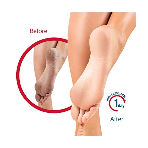 FLEXITOL-Heel-Balm-Medically-Proven-Treatment-for-Dry-and-Cracked-Feet-56g-Gives-Intense-Moisturisation Flexitol Rescue Heel Balm for Dry and Cracked Feet, Intense Moisturisation, Suitable for Diabetics - 56 g