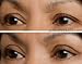 EasyLift The Original 60 Second Eye Lift | As Seen On TV | Lab Tested For Save Everyday Use | Made In the USA