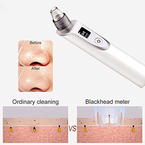 image for Comhere Baby Nasal Aspirator Adult Blackhead Remover Vacuum, USB Elect
