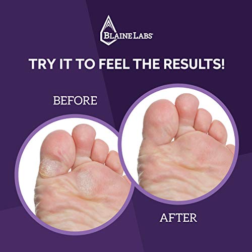 Blaine Labs Vite20 Advanced Callus Treatment Extreme Callus Remover