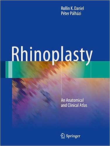 Amazon Rhinoplasty An Anatomical And Clinical Atlas Daniel Rollin K Palhazi Peter Otolaryngology Amazon Rhinoplasty An Anatomical And Clinical Atlas Daniel Rollin K Palhazi Peter Otolaryngology
