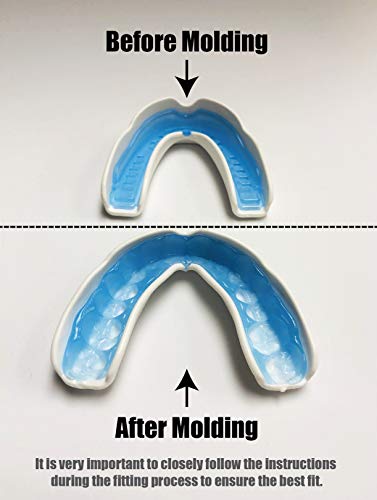 Coollo Sports Boil and Bite Mouth Guard DC Custom Fit Sport Mouthpiece for Karate, Martial Arts, Wrestling, Boxing, MMA (Free Case Included!) -Adult Size (Adult -Ages 11 & Above, Blue & White)