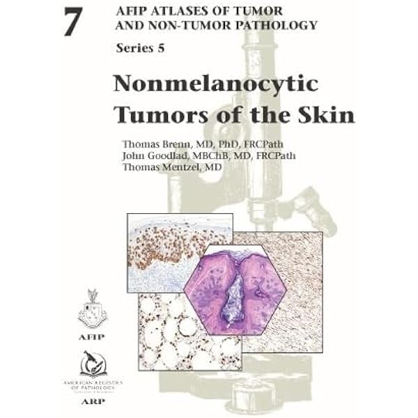 AFIP　Tumors of the Pancreas 【新品】 Tumors of the Pancreas (Afip Atlas of Tumor Pathology; 4th